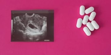 Aborcja – Znaczenie I Symbolika Snów 44