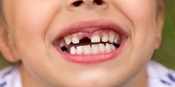 Wypadający Ząb – Znaczenie I Symbolika Snów 23