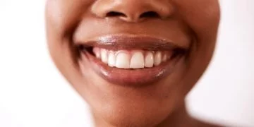 Miękkie Zęby – Znaczenie I Symbolika Snów 16
